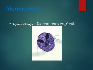 Tricomoníase
 Agente etiológico: Trichomonas vaginalis
 