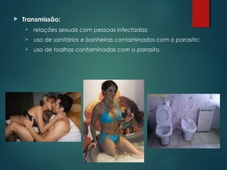  Transmissão:
 relações sexuais com pessoas infectadas;
 uso de sanitários e banheiras contaminados com o parasito;
 uso de toalhas contaminadas com o parasito.
 