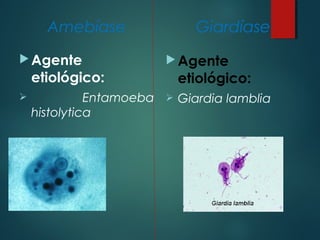 Amebíase
Agente
etiológico:
 Entamoeba
histolytica
Giardíase
Agente
etiológico:
 Giardia lamblia
 