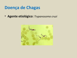Doença de Chagas
• Agente etiológico: Trypanosoma cruzi
 