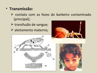 • Transmissão:
   contato com as fezes do barbeiro contaminado
   (principal);
   transfusão de sangue;
   aleitamento materno;
 