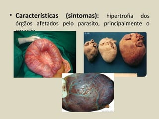 • Características   (sintomas):   hipertrofia dos
  órgãos afetados pelo parasito, principalmente o
  coração.
 