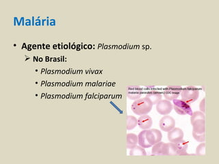 Malária
• Agente etiológico: Plasmodium sp.
   No Brasil:
    • Plasmodium vivax
    • Plasmodium malariae
    • Plasmodium falciparum
 
