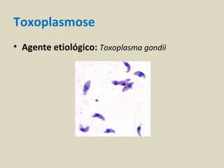 Toxoplasmose
• Agente etiológico: Toxoplasma gondii
 