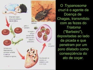 OO TrypanosomaTrypanosoma
cruzicruzi é o agente daé o agente da
Doença deDoença de
Chagas, transmitidoChagas, transmitido
com as fezes docom as fezes do
TriatomaTriatoma
("Barbeiro"),("Barbeiro"),
depositadas ao ladodepositadas ao lado
da picada e queda picada e que
penetram por umpenetram por um
poro dilatado comoporo dilatado como
conseqüência doconseqüência do
ato de coçar.ato de coçar.
 