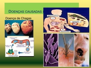 DOENÇAS CAUSADAS POR PROTOZOÁRIOS
Doença de Chagas

 