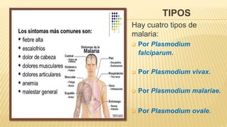 TIPOS
Hay cuatro tipos de
malaria:
 Por Plasmodium
falciparum.
 Por Plasmodium vivax.
 Por Plasmodium malariae.
 Por Plasmodium ovale.
 