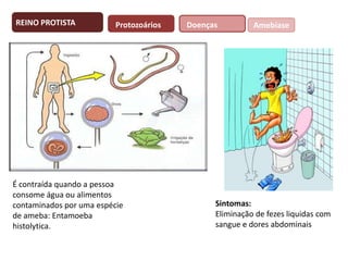 REINO PROTISTA

Protozoários

É contraída quando a pessoa
consome água ou alimentos
contaminados por uma espécie
de ameba: Entamoeba
histolytica.

Doenças

Amebíase

Sintomas:
Eliminação de fezes liquidas com
sangue e dores abdominais

 