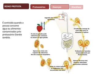 REINO PROTISTA

É contraída quando a
pessoa consome
água ou alimentos
contaminados prlo
protozoário Giardia
lamblia.

Protozoários

Doenças

Giardíase

 