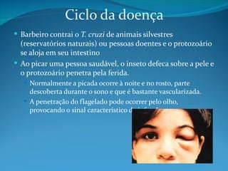 Ciclo da doença
 Barbeiro contrai o T. cruzi de animais silvestres
  (reservatórios naturais) ou pessoas doentes e o protozoário
  se aloja em seu intestino
 Ao picar uma pessoa saudável, o inseto defeca sobre a pele e
  o protozoário penetra pela ferida.
    Normalmente a picada ocorre à noite e no rosto, parte
     descoberta durante o sono e que é bastante vascularizada.
    A penetração do flagelado pode ocorrer pelo olho,
     provocando o sinal característico da infecção.
 