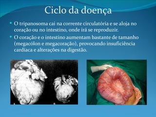 Ciclo da doença
 O tripanosoma cai na corrente circulatória e se aloja no
  coração ou no intestino, onde irá se reproduzir.
 O coração e o intestino aumentam bastante de tamanho
  (megacólon e megacoração), provocando insuficiência
  cardíaca e alterações na digestão.
 