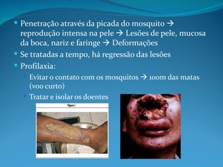  Penetração através da picada do mosquito 
  reprodução intensa na pele  Lesões de pele, mucosa
  da boca, nariz e faringe  Deformações
 Se tratadas a tempo, há regressão das lesões
 Profilaxia:
   Evitar o contato com os mosquitos  100m das matas
    (voo curto)
   Tratar e isolar os doentes
 