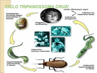 CICLO TRIPANOSSOMA CRUZI
 