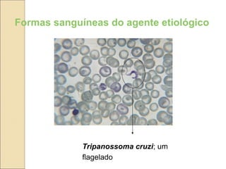 Formas sanguíneas do agente etiológico
Tripanossoma cruzi; um
flagelado
 