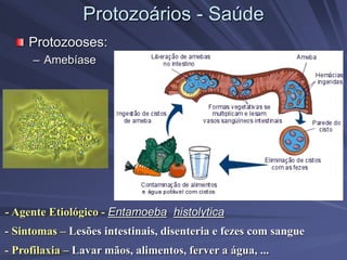 Protozoários - Saúde
Protozooses:
– Amebíase
- Agente Etiológico - Entamoeba histolytica
- Sintomas – Lesões intestinais, disenteria e fezes com sangue
- Profilaxia – Lavar mãos, alimentos, ferver a água, ...
 