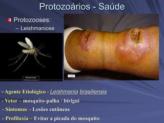 Protozoários - Saúde
Protozooses:
– Leishmaniose
- Vetor – mosquito-palha / birigui
- Agente Etiológico - Leishmania brasiliensis
- Sintomas – Lesões cutâneas
- Profilaxia – Evitar a picada do mosquito
 