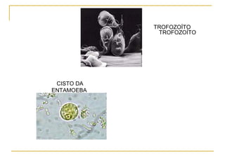 TROFOZOÍTO
TROFOZOÍTO
CISTO DA
ENTAMOEBA
 