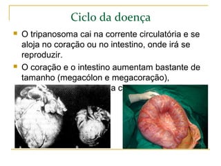 Ciclo da doença
 O tripanosoma cai na corrente circulatória e se
aloja no coração ou no intestino, onde irá se
reproduzir.
 O coração e o intestino aumentam bastante de
tamanho (megacólon e megacoração),
provocando insuficiência cardíaca e alterações
na digestão.
 