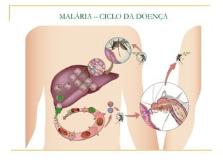 MALÁRIA – CICLO DA DOENÇA
 