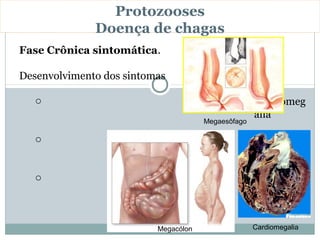 Protozooses
              Doença de chagas
Fase Crônica sintomática.

Desenvolvimento dos sintomas

   o                                                Cardiomeg
                                                    alia
                                      Megaesôfago

   o                                                Megaesôfa
                                                    go

   o                                                Megacólon



                          Megacólon                 Cardiomegalia
 