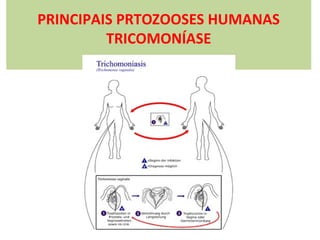 PRINCIPAIS PRTOZOOSES HUMANAS
TRICOMONÍASE

 