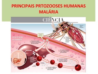 PRINCIPAIS PRTOZOOSES HUMANAS
MALÁRIA

 