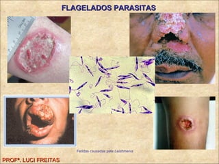 FLAGELADOS PARASITAS PROFª. LUCI FREITAS Feridas causadas pela  Leishmania 