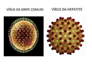 VÍRUS DA GRIPE COMUM   VÍRUS DA HEPATITE
 