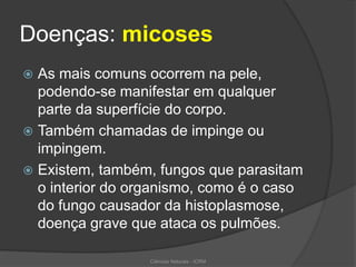 Doenças: micoses
 As mais comuns ocorrem na pele,
podendo-se manifestar em qualquer
parte da superfície do corpo.
 Também chamadas de impinge ou
impingem.
 Existem, também, fungos que parasitam
o interior do organismo, como é o caso
do fungo causador da histoplasmose,
doença grave que ataca os pulmões.
Ciências Naturais - ICRM
 
