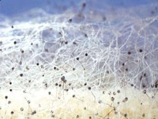 Algunos son muy útiles y se utilizan en la
alimentación y otros en la medicina para
obtención de antibióticos como la
Penicilina que se obtiene del Penicilium
notatum.
 