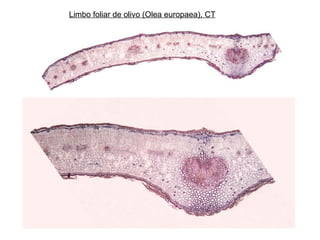Limbo foliar de olivo (Olea europaea), CT
 