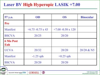 Laser BV  High Hyperopic  LASIK +7.00 57 y.o. OD OS Binocular Pre Manifest +6.75 -0.75 x 43 +7.00 -0.50 x 120 BSCVA 20/25 20/20 6 Mo Post Enh UCVA 20/32 20/20 20/20 & N5 Manifest -1.25 sph +0.25 sph BSCVA 20/20 20/20 