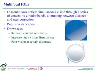 Multifocal IOLs Discontinuous optics: simultaneous vision through a series of concentric circular bands, alternating between distance and near correction Pupil size dependent Drawbacks: Reduced contrast sensitivity Increase night vision disturbances Poor vision at certain distances 
