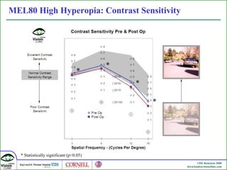 MEL80 High Hyperopia: Contrast Sensitivity * * * * * Statistically significant (p<0.05) 