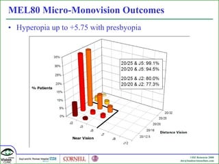 MEL80 Micro-Monovision Outcomes Hyperopia up to +5.75 with presbyopia 