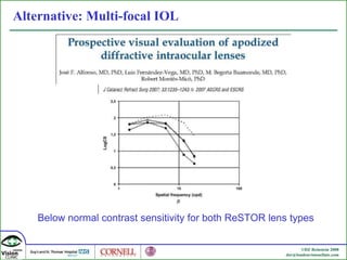 Alternative: Multi-focal IOL Below normal contrast sensitivity for both ReSTOR lens types 