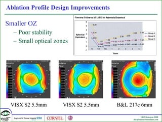 Ablation Profile Design Improvements Smaller OZ Poor stability Small optical zones VISX S2 5.5mm VISX S2 5.5mm B&L 217c 6mm 