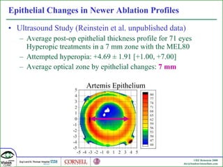 Epithelial Changes in Newer Ablation Profiles Ultrasound Study (Reinstein et al. unpublished data) Average post-op epithelial thickness profile for 71 eyes Hyperopic treatments in a 7 mm zone with the MEL80 Attempted hyperopia: +4.69  ± 1.91 [+1.00, +7.00] Average optical zone by epithelial changes:  7 mm Artemis Epithelium 