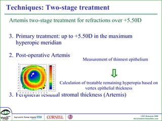 Techniques: Two-stage treatment Artemis two-stage treatment for refractions over +5.50D Primary treatment: up to +5.50D in the maximum hyperopic meridian 2. Post-operative Artemis  3. Peripheral residual stromal thickness (Artemis) Measurement of thinnest epithelium Calculation of treatable remaining hyperopia based on vertex epithelial thickness 