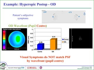 Example: Hyperopic Postop - OD Patient’s subjective symptoms OD Wavefront (Pupil   Centre ) Visual Symptoms do NOT match PSF by wavefront ( pupil centre) 