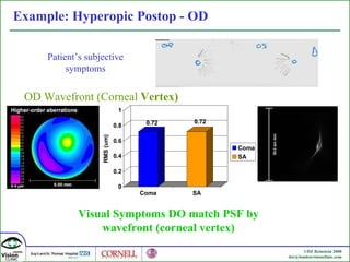 Example: Hyperopic Postop - OD Patient’s subjective symptoms OD Wavefront (Corneal  Vertex) Visual Symptoms DO match PSF by wavefront ( corneal vertex) 