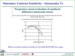 Outcomes: Contrast Sensitivity – Intraocular Tx Below normal contrast sensitivity for both ReSTOR lens types 
