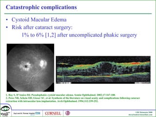 Catastrophic complications Cystoid Macular Edema  Risk after cataract surgery: 1% to 6% [1,2] after uncomplicated phakic surgery 1. Ray S, D’Amico DJ. Pseudophakic cystoid macular edema. Semin Ophthalmol. 2002;17:167-180. 2. Powe NR, Schein OD, Gieser SC, et al. Synthesis of the literature on visual acuity and complications following cataract extraction with intraocular lens implantation. Arch Ophthalmol. 1994;112:239-252. 