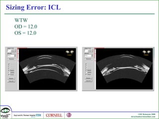 Sizing Error: ICL WTW  OD = 12.0 OS = 12.0 