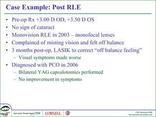 Case Example: Post RLE Pre-op Rx +3.00 D OD, +3.50 D OS No sign of cataract Monovision RLE in 2003 – monofocal lenses Complained of misting vision and felt off balance 3 months post-op, LASIK to correct “off balance feeling” Visual symptoms made worse Diagnosed with PCO in 2006 Bilateral YAG capsulotomies performed No improvement in symptoms 