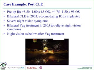 Case Example: Post CLE Pre-op Rx +5.50 -1.00 x 85 OD, +4.75 -1.50 x 95 OS Bilateral CLE in 2003; accomodating IOLs implanted Severe night vision symptoms Bilateral Yag treatment in 2005 to relieve night vision symptoms Night vision as below after Yag treatment 