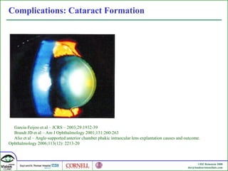 Complications: Cataract Formation Garcia-Feijoo et al – JCRS – 2003;29:1932-39 Brandt JD et al – Am J Ophthalmology 2001;131:260-263 Alio et al – Angle-supported anterior chamber phakic intraocular lens explantation causes and outcome. Ophthalmology 2006;113(12): 2213-20 