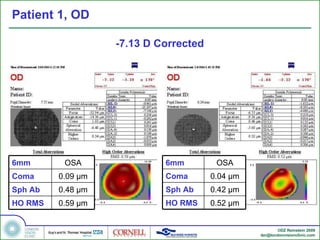 Patient 1, OD -7.13 D Corrected 6mm OSA Coma 0.04  µm Sph Ab 0.42  µm HO RMS 0.52  µm 6mm OSA Coma 0.09  µm Sph Ab 0.48  µm HO RMS 0.59  µm 