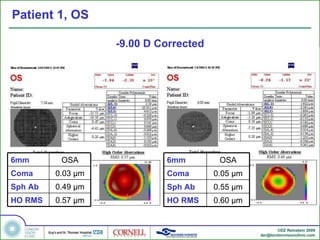 Patient 1, OS -9.00 D Corrected 6mm OSA Coma 0.03  µm Sph Ab 0.49 µm HO RMS 0.57  µm 6mm OSA Coma 0.05  µm Sph Ab 0.55 µm HO RMS 0.60  µm 