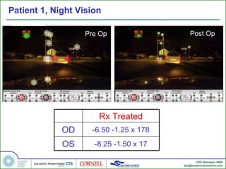 Patient 1, Night Vision Pre Op Post Op Rx Treated OD -6.50 -1.25 x 178 OS -8.25 -1.50 x 17 